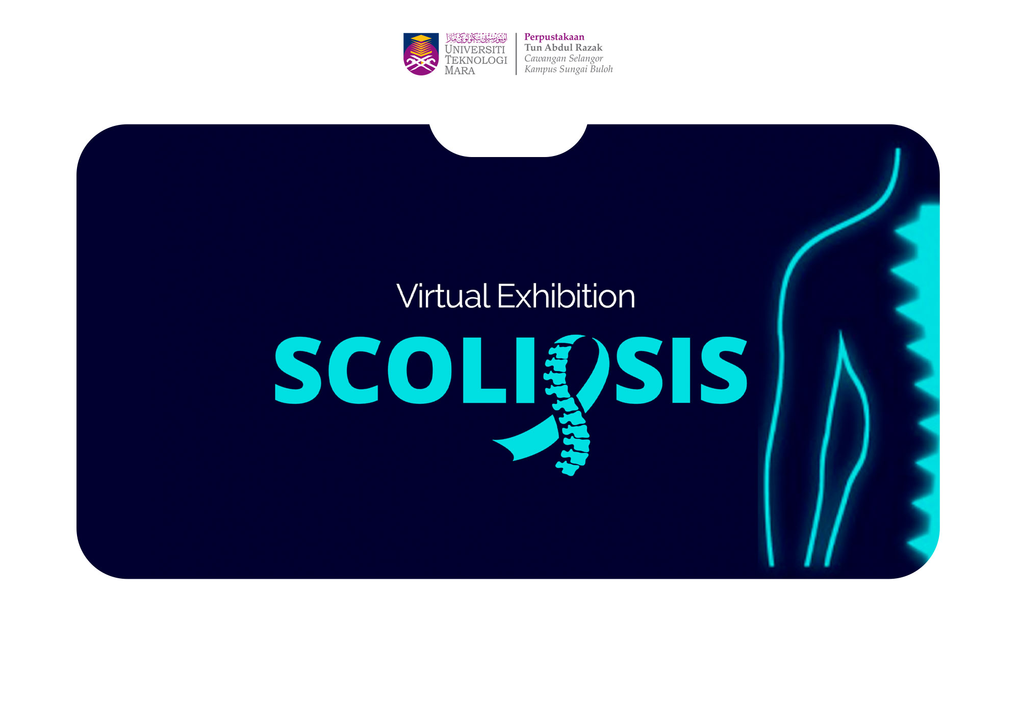 Virtual Exhibition : Scoliosis